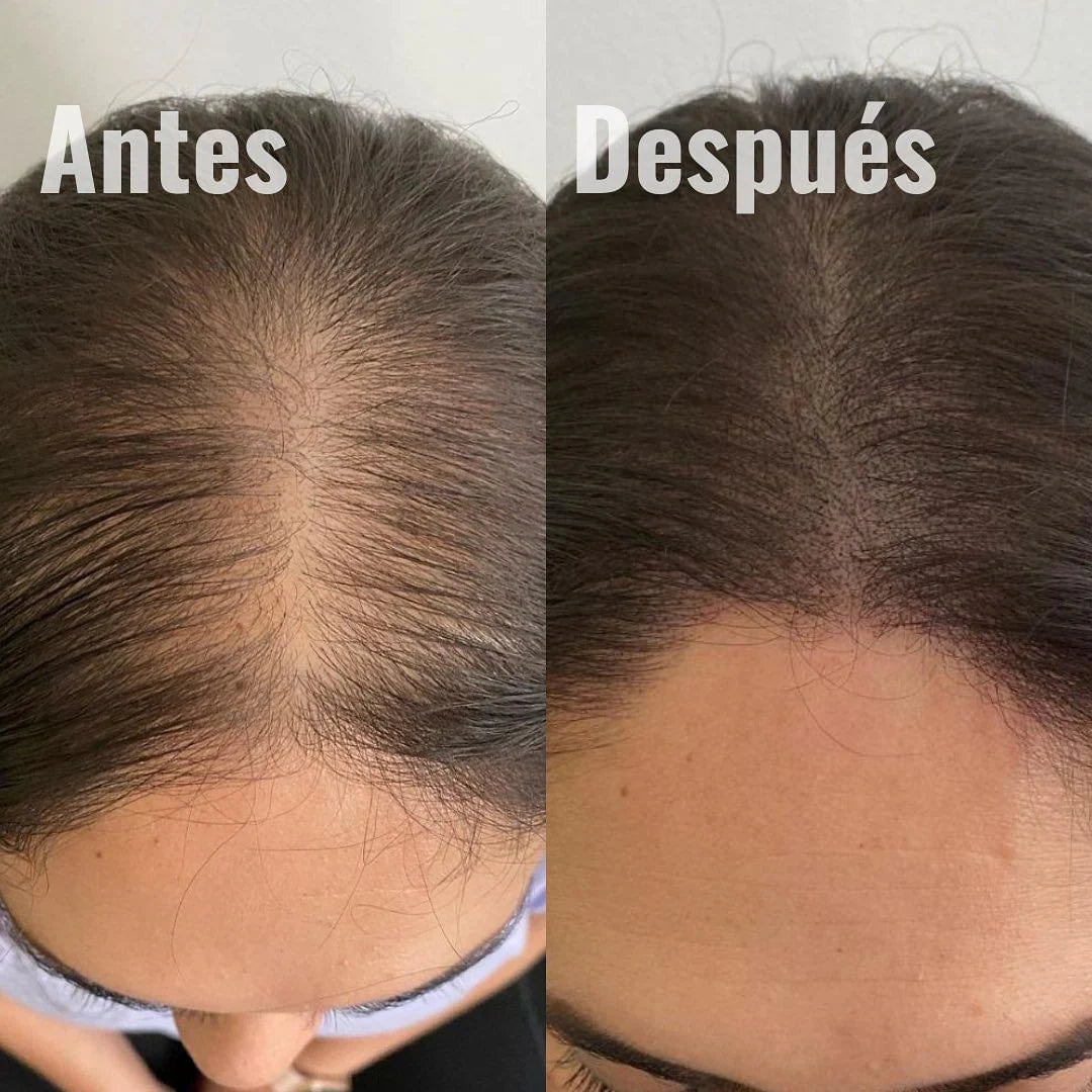 ORDINARY MULTIPEPTIDO 🌟